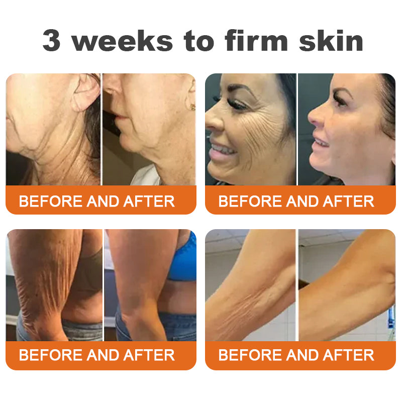 🧖‍♀️Made and Shipped from USA💕Flysmus™ Botox Bee Venom Firming Serum Stick🕒LAST DAY 70% OFF