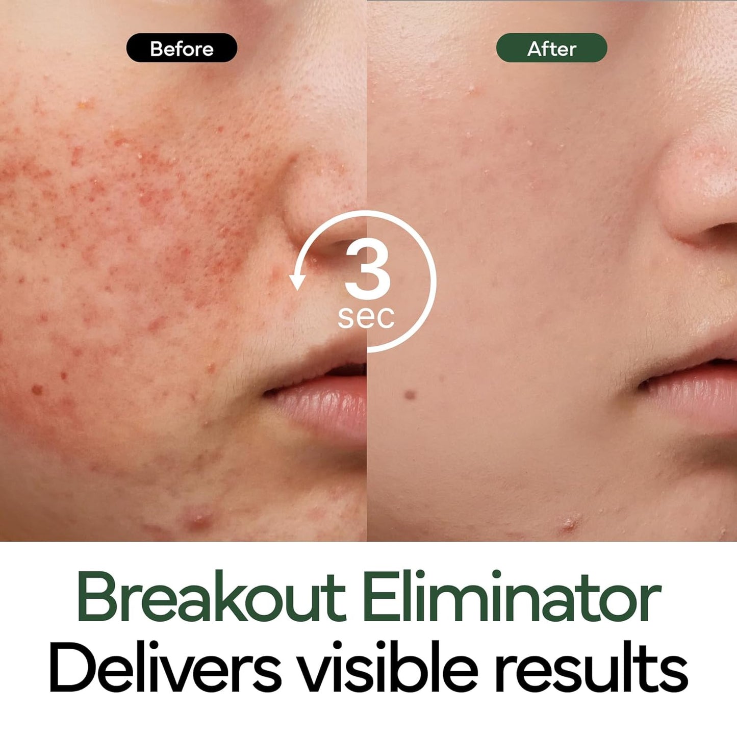 🕒Last 3 hours: 60% off🕒Intensive Cica Repair Cream – Calm & Repair Damaged Skin, Perfect for Sensitive Skin