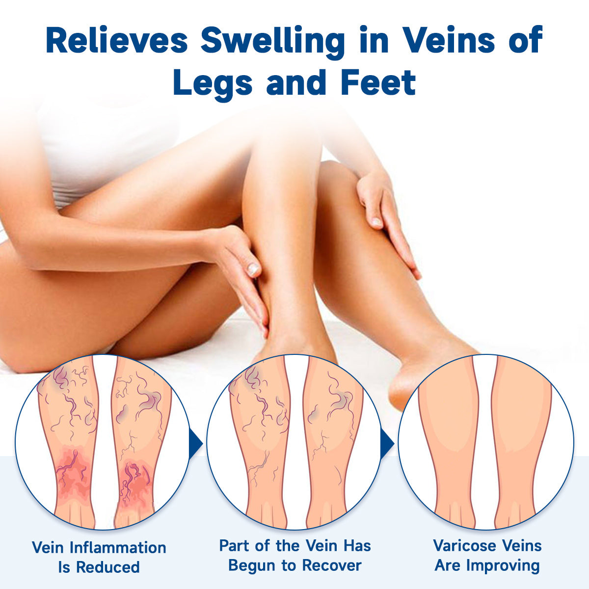 🧖‍♀️Targets Varicose Veins, Spider Veins, Leg Swelling, and Leg Fatigue. Ourlyard® Varicose Vein Stick Delivers Incredible Relief. Don't Miss 30% Off Today!