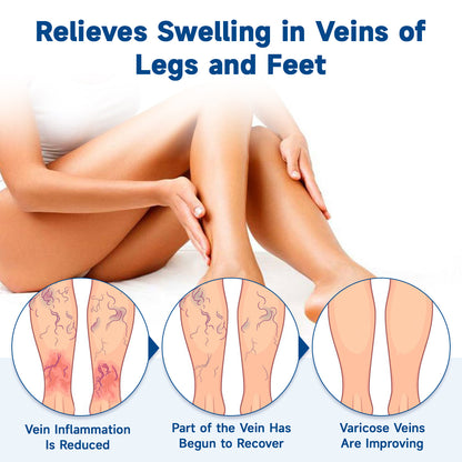 🧖‍♀️Targets Varicose Veins, Spider Veins, Leg Swelling, and Leg Fatigue. Ourlyard® Varicose Vein Stick Delivers Incredible Relief. Don't Miss 30% Off Today!