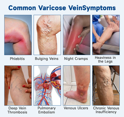 🧖‍♀️Targets Varicose Veins, Spider Veins, Leg Swelling, and Leg Fatigue. Ourlyard® Varicose Vein Stick Delivers Incredible Relief. Don't Miss 30% Off Today!