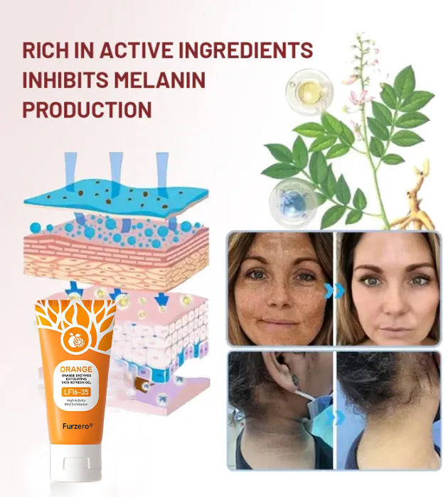🕒Final 3 Hours–60% Off!🕒Furzero® Orange Enzyme Exfoliating Gel — The Gentle Miracle Your Skin Has Been Crying Out For