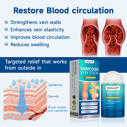 🧖‍♀️Targets Varicose Veins, Spider Veins, Leg Swelling, and Leg Fatigue. Ourlyard® Varicose Vein Stick Delivers Incredible Relief. Don't Miss 30% Off Today!