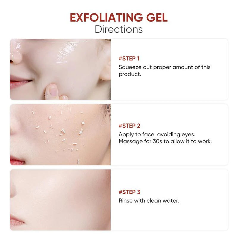 🕒Final 3 Hours–60% Off!🕒Furzero® Orange Enzyme Exfoliating Gel — The Gentle Miracle Your Skin Has Been Crying Out For