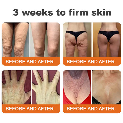 🧖‍♀️Made and Shipped from USA💕Flysmus™ Botox Bee Venom Firming Serum Stick🕒LAST DAY 70% OFF