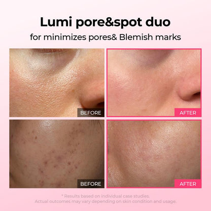 [Divifit]🕒Lumi Pore & Spot Care Duo | Shrinks Pores & Fades Blemish Marks | Cyano Pink Spicule Serum + Picotonic Shot Ampoule  [🕒Limited Time Offer]
