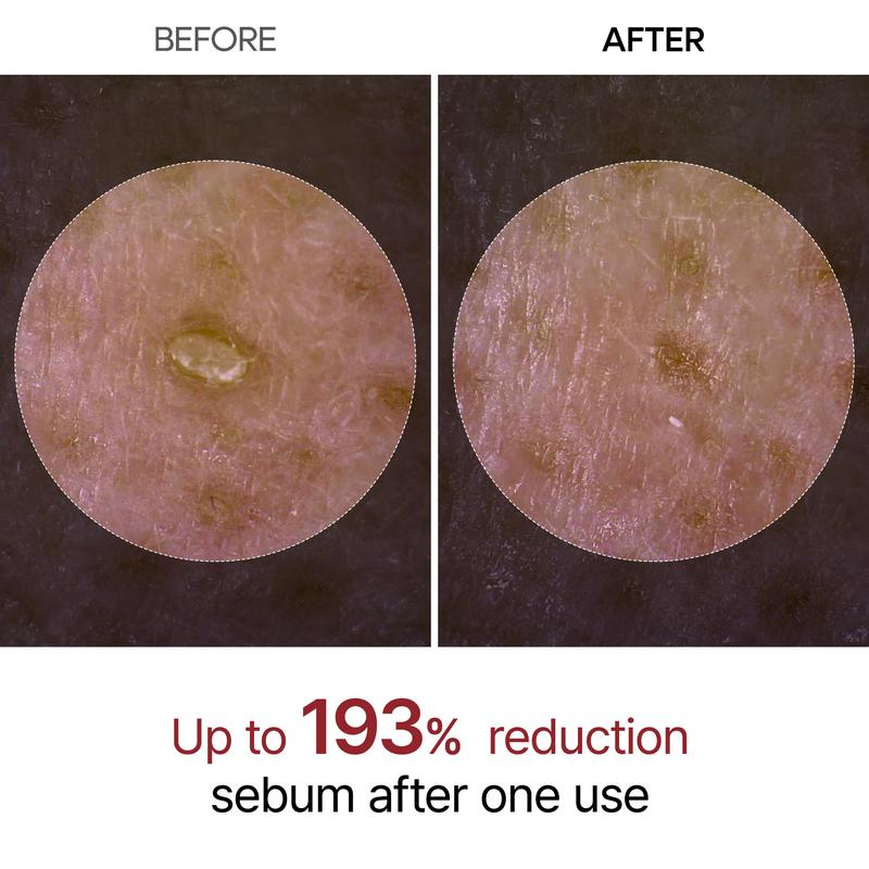 🕒PeelShot Glow Rice Ampoule Duo